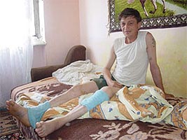 In urma caderii de pe bloc Mircea Ban si-a fracturat doar calcaiul